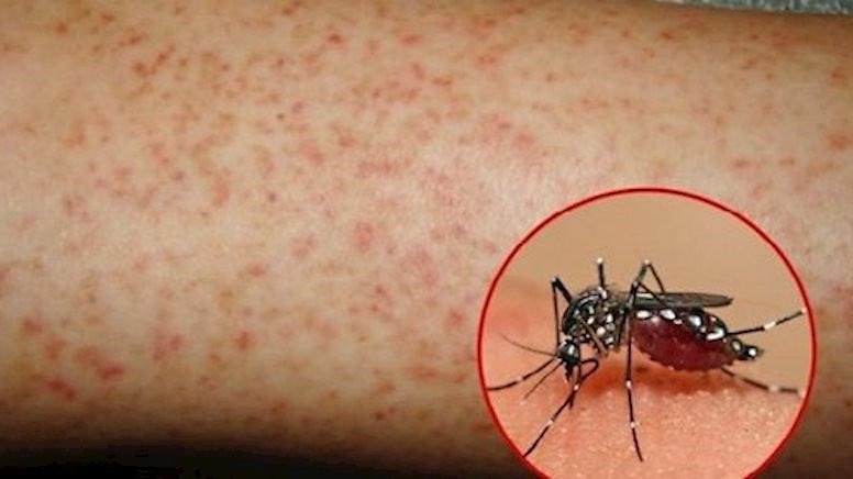 phòng muỗi chống sốt xuất huyết