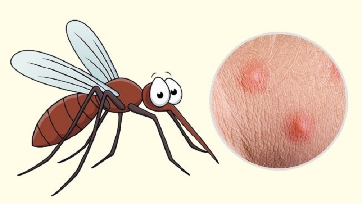 Bị muỗi đốt nhiều nên làm gì? Cách giảm sưng ngứa sau 3 giây