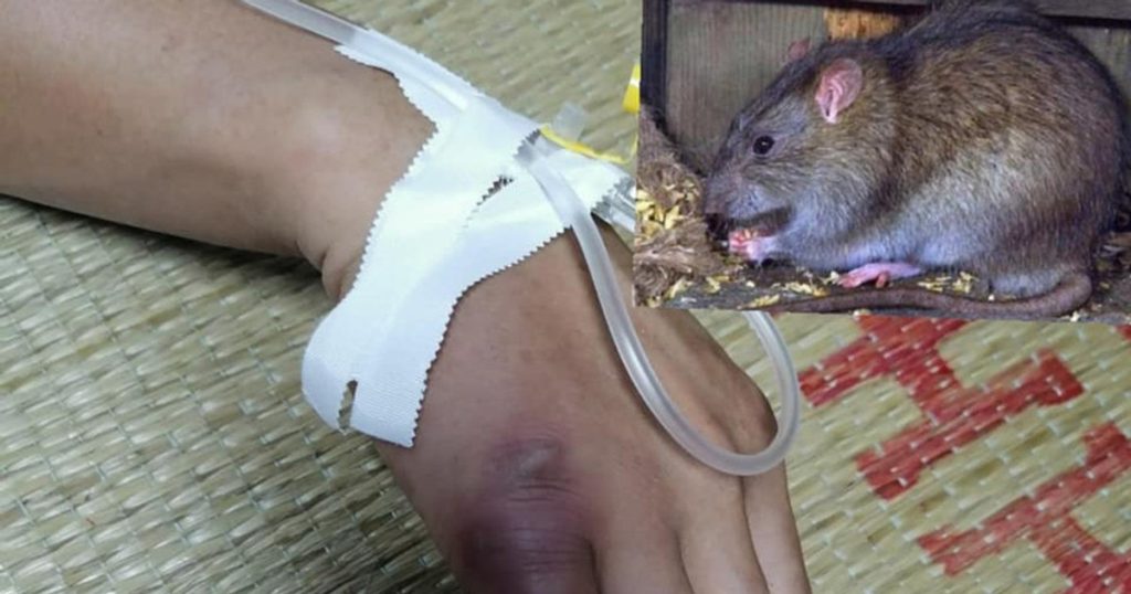 chuột gây ra bệnh gì, bị chuột cắn nhẹ có sao không, bị chuột cắn ở ngón tay có sao không, bị chuột cắn khi ngủ, lỡ ăn thức ăn bị chuột gặm có sao không, máu chuột có độc không, chuột cắn chảy máu có sao không