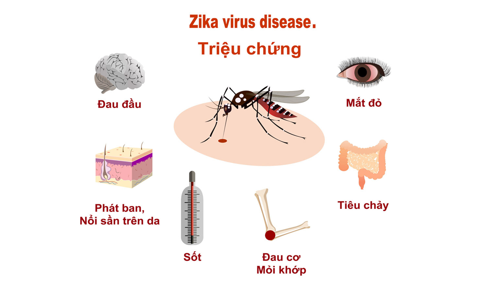 virus Zika, cách phòng tránh virus Zika, xịt chống muỗi thiên nhiên, xịt chống muỗi, xịt muỗi thiên nhiên, xịt chống muỗi thiên nhiên heroh