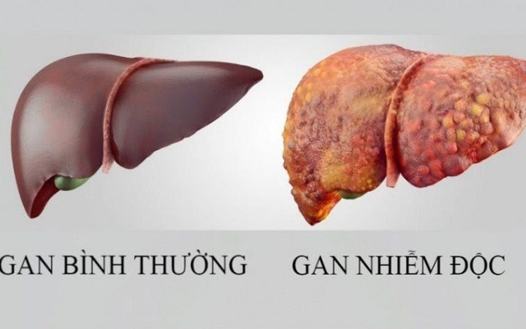 giải độc gan, cách giải độc gan, thanh lọc cơ thể, uống gì để giải độc gan, thức uống giải rượu Acol Detox
